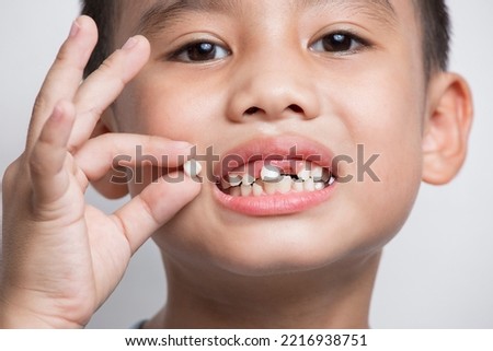close up face baby Asian hold showing open mouth temporary lost tooth teeth milk tooth 