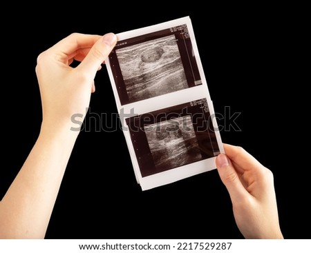 Breast scan in hands. Ultrasound diagnostics of cancer and fibroadenoma. High quality photo