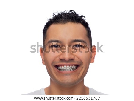 face of a young Latino man with dark skin smiles at the camera, shows if orthodontic treatment, stainless steel braces and garters, one person Royalty-Free Stock Photo #2218531769