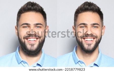 Double chin problem. Collage with photos of man before and after plastic surgery procedure on light grey background