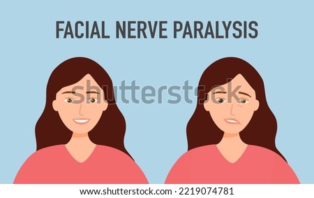 Facial nerve paralysis concept vector illustration. Face palsy. Royalty-Free Stock Photo #2219074781