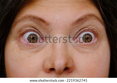 middle-aged mature woman with bulging eyes, upper face close-up, goggle eyes in fright, staring at camera, Very strong surprise or fright, horror in look, concept of cosmetic anti-aging procedures Royalty-Free Stock Photo #2219362745