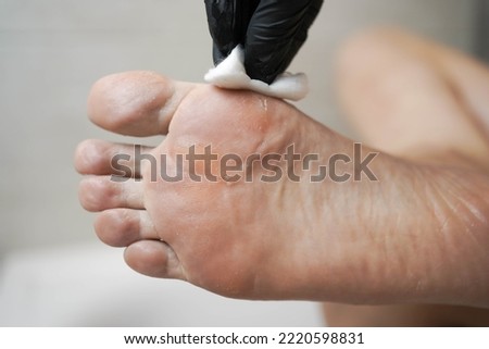 Pedicure at home. Acid pedicure. Foot close-up.