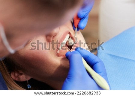 Dentist checks teeth in clinic. Prevention of the oral cavity of a girl at the dentist. Close-up