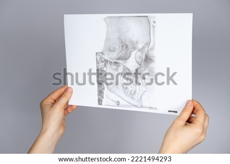 The doctor holds a CT scan of a patient with temporomandibular joint dysfunction and malocclusion Royalty-Free Stock Photo #2221494293