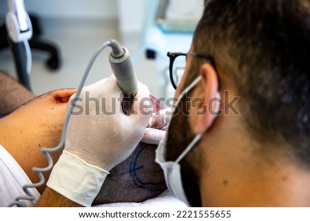 hair transplant in istanbul turkey, different stages, using FUE and DHI technique, micro-engine. Royalty-Free Stock Photo #2221555655