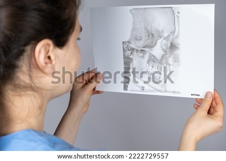 The doctor holds a CT scan of a patient with temporomandibular joint dysfunction and malocclusion. Royalty-Free Stock Photo #2222729557