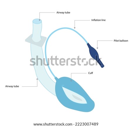 LARYNGEAL-MASK-AIRWAY Stock Vector Images - Avopix.com