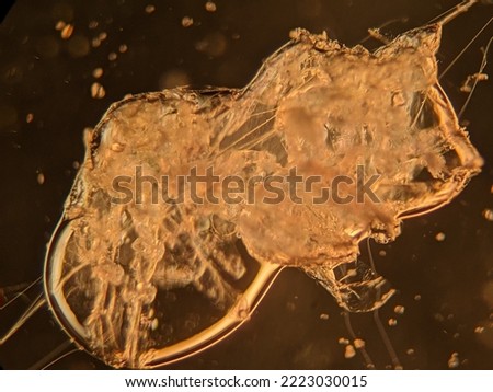 photo of dead spider exoskeleton under the microscope