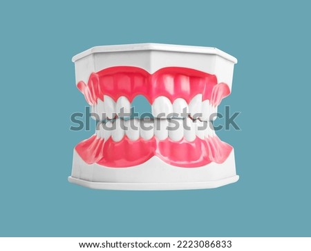 Tooth loss concept. Missing teeth in jaw model on background. Dentistry problems. Gap, absence. High quality photo Royalty-Free Stock Photo #2223086833