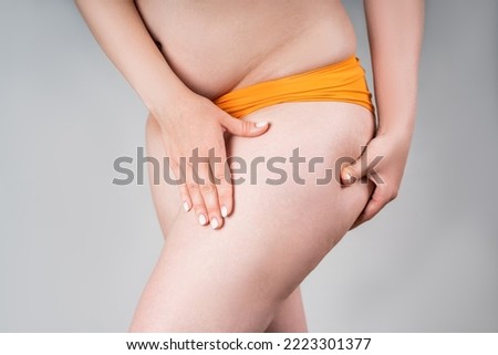 Overweight woman, fat thighs and buttocks, obesity female legs with cellulite on gray background
