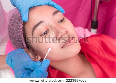 An Esthetician applying numbing cream or local anesthetic to small moles or warts on a patient's face with a cotton swab before electrocautery procedure at an aesthetic center and dermatology clinic.