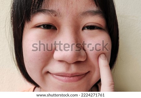 portrait showing the fingers pointing the cheek on the face of teenage girl, smile and happiness, facial expression of the teen, concept health care and beauty.