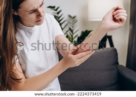 Unhealthy sad young brunette female sitting on couch have skin problems, feels unbearable pain at home. Wound skin burns. Dermatology, beauty care from skin problem by medical treatment concept Royalty-Free Stock Photo #2224373419
