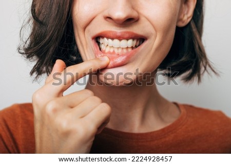Close up shot of gum inflammation. Cropped shot of a young woman showing red bleeding gums isolated on a gray background. Dentistry, dental care Royalty-Free Stock Photo #2224928457