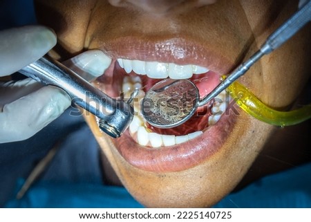 Dentist examining a patient's teeth with dental tools - mirror and probe. Dentistry.