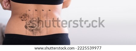 Laser Tattoo Removal Before After. Isolated Woman Royalty-Free Stock Photo #2225539977