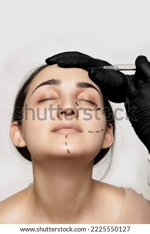 a woman's face with lines drawn on her cheeks and eyebrows, being injected by a syline injection Royalty-Free Stock Photo #2225550127