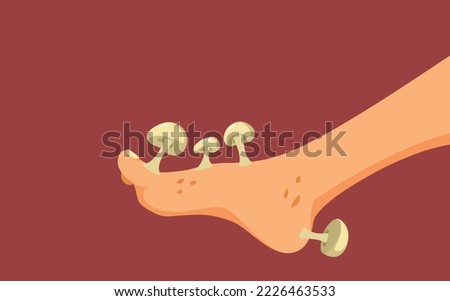 Foot with Fungus Problem Concept Cartoon Illustration. Person dealing with mycosis and tinea pedis skin problems Royalty-Free Stock Photo #2226463533