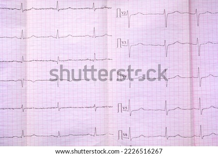 sheet of pink millimeter paper with diagram of a medical examination of the heart on an electrocardiogram Royalty-Free Stock Photo #2226516267