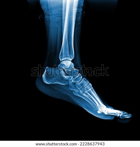 X-ray normal  foot . Lateral view Royalty-Free Stock Photo #2228637943