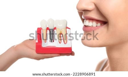 Young woman with beautiful smile and dentist holding educational model of dental implant on white background, closeup Royalty-Free Stock Photo #2228906891