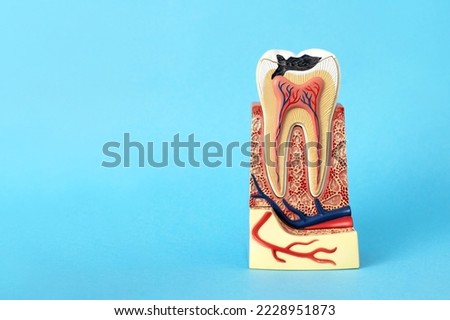 Model of imitation of a tooth made of plastic at the initial stage of caries. Tooth in section with canals. Dental care concept. Copy space. Royalty-Free Stock Photo #2228951873