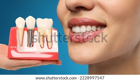 Young woman with beautiful smile and dentist holding educational model of dental implant on blue background, closeup Royalty-Free Stock Photo #2228997547