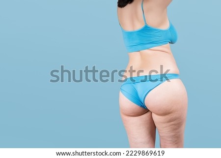 Overweight thigh, woman with fat hips and buttocks, obesity female body with cellulite on blue background with copy space, studio shot