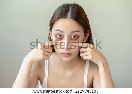 Bored, insomnia asian young woman, girl looking at camera, hand touching under eyes with problem of black circles or panda puffy, swollen and wrinkle on face. Sleepless, sleepy healthcare person.