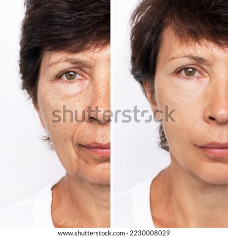 Comparison of aged and young woman's face. Youth, old age. The process of aging and rejuvenation, the result years later. Beauty treatment and lifting. Result of plastic surgery. Rejuvenation