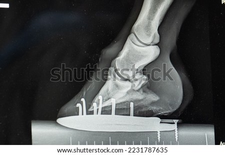 close up x-ray of horses lower front leg showing horse show and nails as well as hoof foot ankle and other lower equine leg bones x-ray taken by veterinarian to diagnose foot ir leg lameness issue  Royalty-Free Stock Photo #2231787635