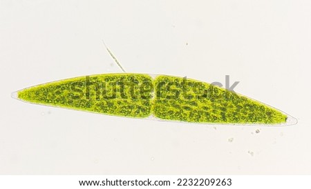 Freshwater phytoplankton, closterium lunula. live cell. 400x magnification with selective focus Royalty-Free Stock Photo #2232209263