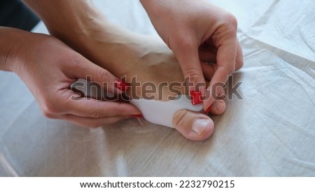 Treatment and prevention of hallux valgus. Woman applies valgus splint, silicone finger spacer close up. Royalty-Free Stock Photo #2232790215