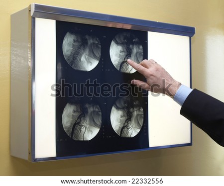 brain x-ray in a x-ray lab exposed