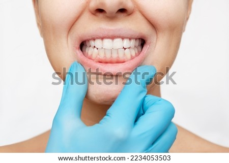 Correct bite. Cropped shot of a young woman's face with doctor's hand in a blue glove showing healthy gums isolated on a white background. Examination at the dentist. Dentistry, dental care Royalty-Free Stock Photo #2234053503