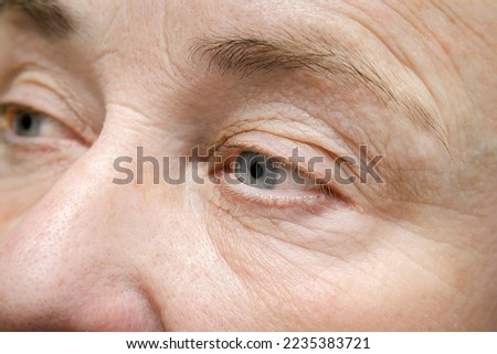 Portrait of wrinkled face of elderly mature older middle aged woman, close up of beautiful female eyes with dry skin.cosmetology care treatment,age skin care beauty cream,medicine,plastic surgery Royalty-Free Stock Photo #2235383721