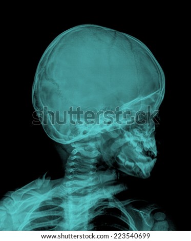 Children skull x-rays image vertical