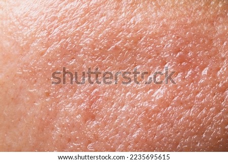 Closeup view of human oily skin as background Royalty-Free Stock Photo #2235695615