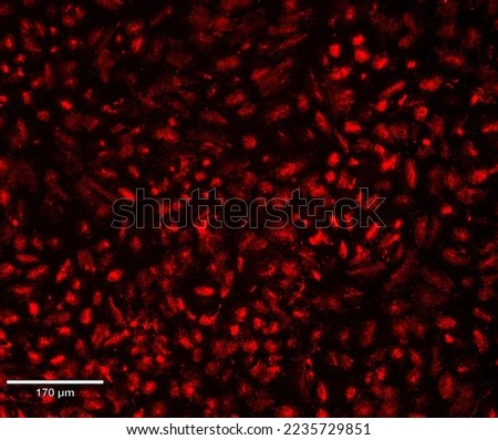 Immunofluorescence staining use in research laboratory including cell culture, tissue culture or tissue biopsy. The application of this technique is cancer biology study. 