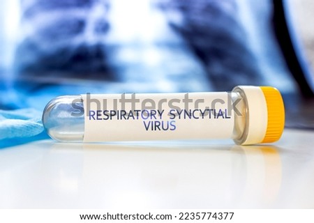 Respiratory Syncytial Virus with lung ct scan aside on light blue background. RSV disease concept Royalty-Free Stock Photo #2235774377