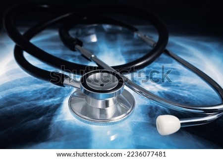 Medical Phonendoscope on a lung X-ray of a patient. Stethoscope to auscultate patients over torax radiography for diagnosis of lung diseases Royalty-Free Stock Photo #2236077481