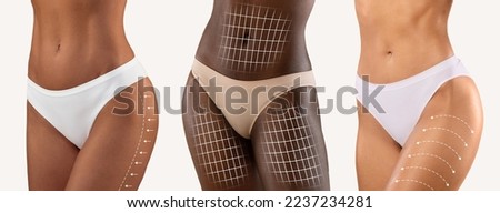 Millennial diverse females in bikini with perfect skin, lines for body shaping or drainage massage and laser therapy isolated on white background, studio. Contouring plastic surgery and fit results Royalty-Free Stock Photo #2237234281