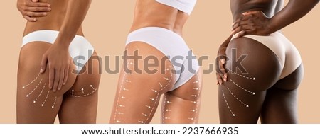 Millennial different women in bikini with perfect skin, slim body with lines for figure shaping, drainage massage isolated on beige background, studio. Cosmetology beauty care, plastic surgery results Royalty-Free Stock Photo #2237666935