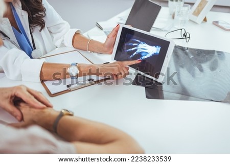 Doctor and patient looking at x-ray and hand in doctor's office. Close-up of female hands holding skiagram. Serious surgeon looking attentively on wrist x-ray and making diagnosis.  Royalty-Free Stock Photo #2238233539