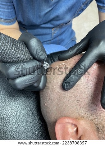 Performing hair micropigmentation procedure First session Royalty-Free Stock Photo #2238708357