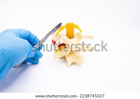 Neurosurgery and operations on the spinal cord and spine concept photo. Model of the spinal cord with nerve roots and a gloved hand of a surgeon with a scalpel on a white background Royalty-Free Stock Photo #2238745027
