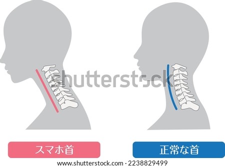 Comparison of smartphone neck and normal neck

In Japanese, it says "smartphone neck" and "normal cervical spine"