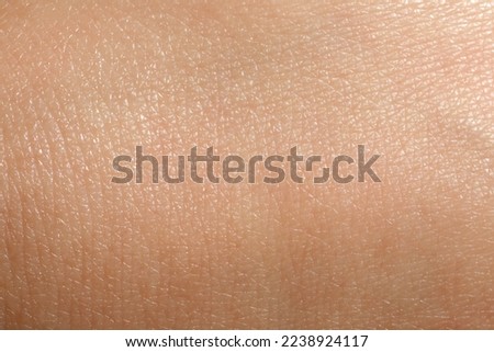 Closeup view of dry human skin as background Royalty-Free Stock Photo #2238924117