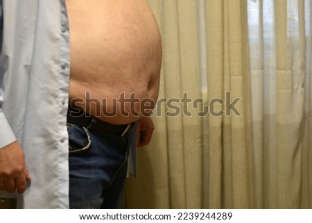 The picture shows a shirtless man with a large fat belly.